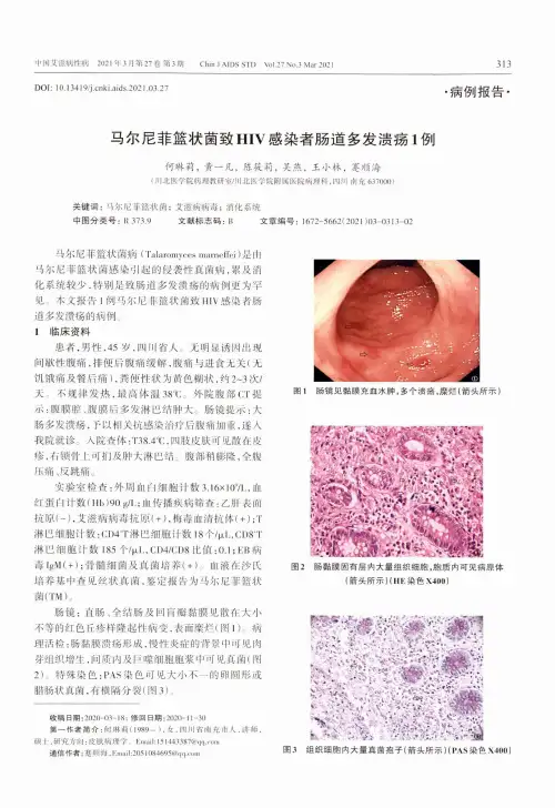 马尔尼菲篮状菌致HIV感染者肠道多发溃疡1例