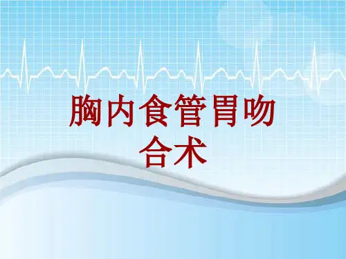 手术讲解模板：胸内食管胃吻合术