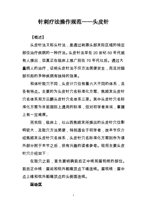 针刺疗法操作规范——头皮针