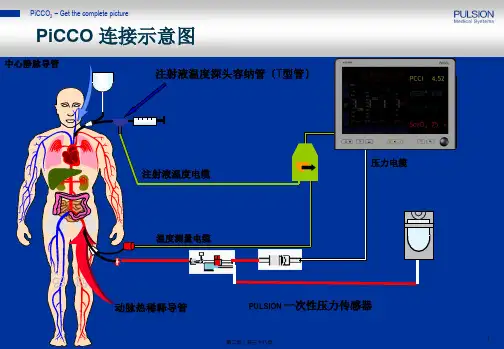 PiCCO参数解读阜外医院