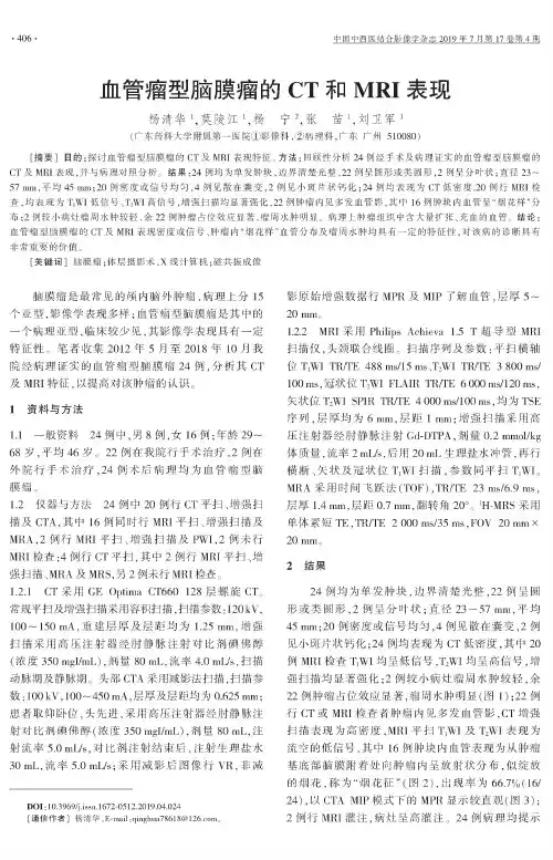 血管瘤型脑膜瘤的CT和MRI表现