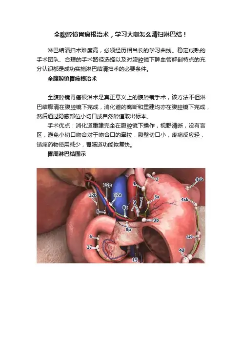 全腹腔镜胃癌根治术，学习大咖怎么清扫淋巴结！