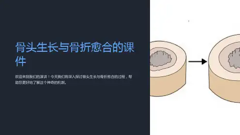 “骨头生长与骨折愈合的课件”