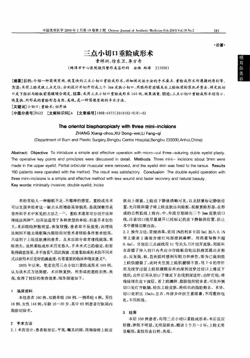 三点小切口重睑成形术