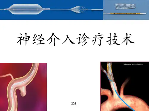 神经介入概述PPT课件