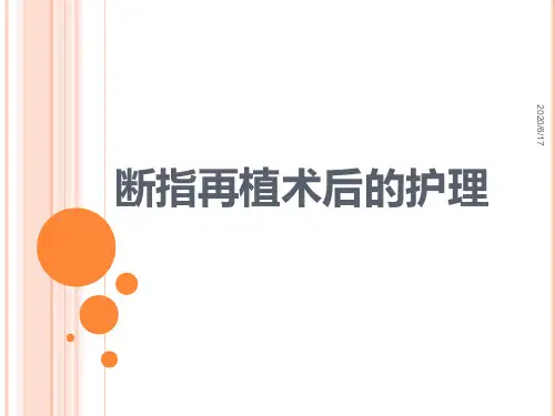 断指再植术后的护理PPT课件