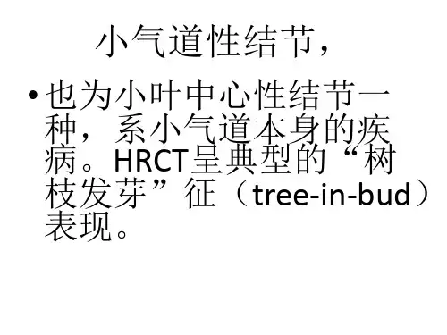 胸部CT影像征象图解2