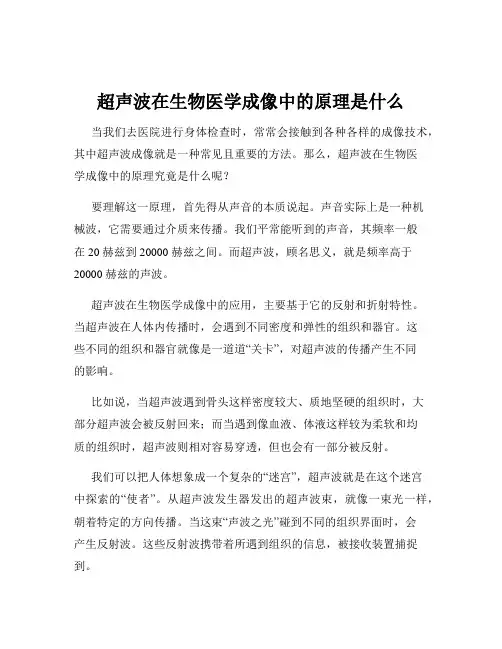 超声波在生物医学成像中的原理是什么