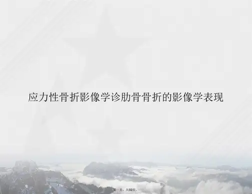 应力性骨折影像学诊肋骨骨折的影像学表现2讲课文档