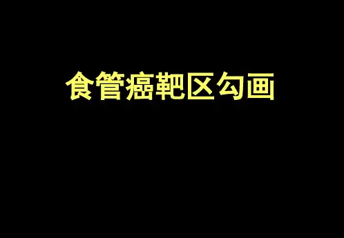 规培课件—食管癌的靶区勾画(含术后靶区)