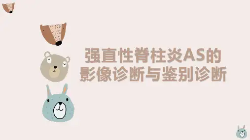 强直性脊柱炎的影像诊断与鉴别诊断