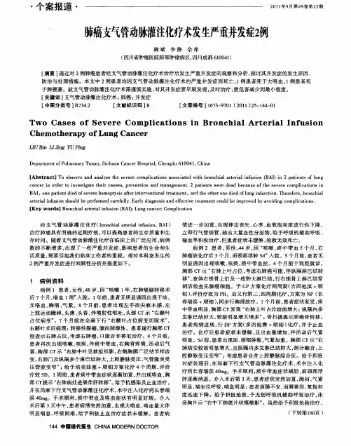 肺癌支气管动脉灌注化疗术发生严重并发症2例