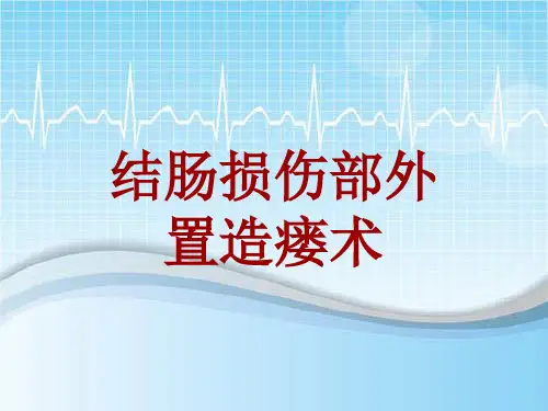 外科手术教学资料：结肠损伤部外置造瘘术讲解模板