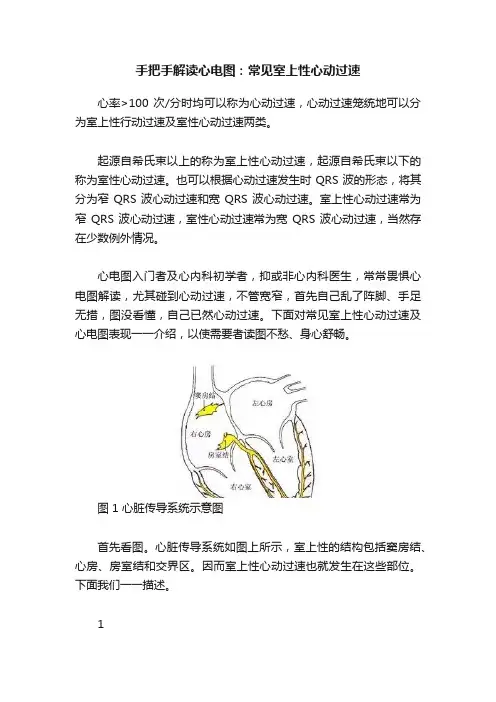 手把手解读心电图：常见室上性心动过速