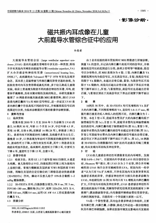 磁共振内耳成像在儿童大前庭导水管综合征中的应用