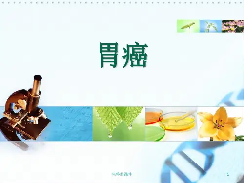 胃癌ppt课件