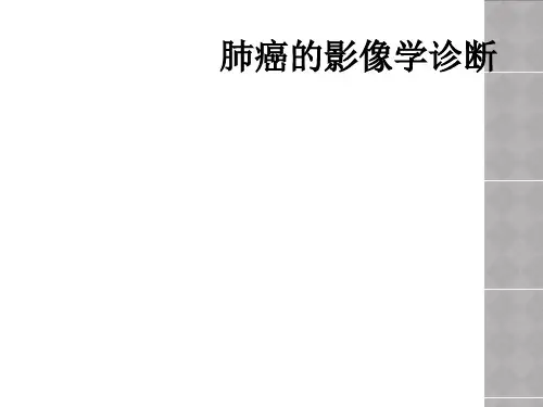 肺癌的影像学诊断