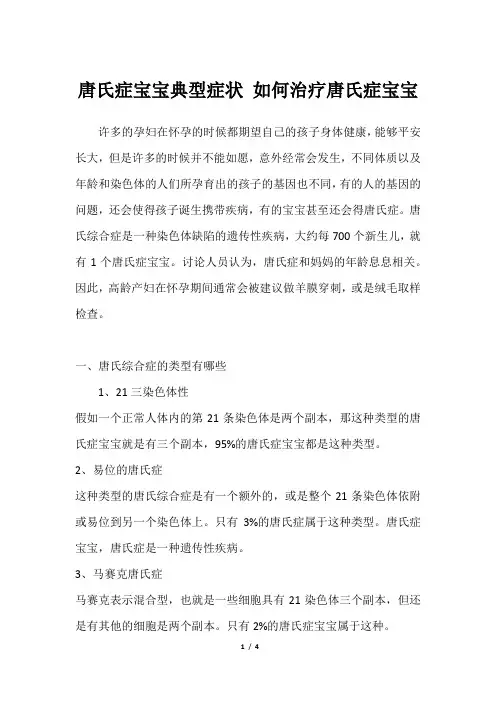 唐氏症宝宝典型症状 如何治疗唐氏症宝宝