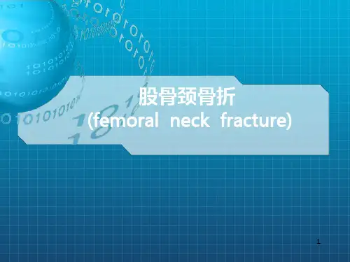 股骨颈骨折〖精品课件〗