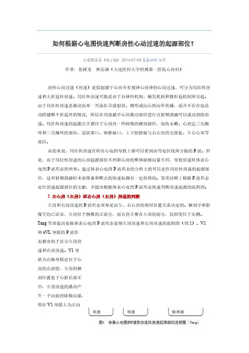 如何根据心电图疾速判断房性心动过速的起源部位？