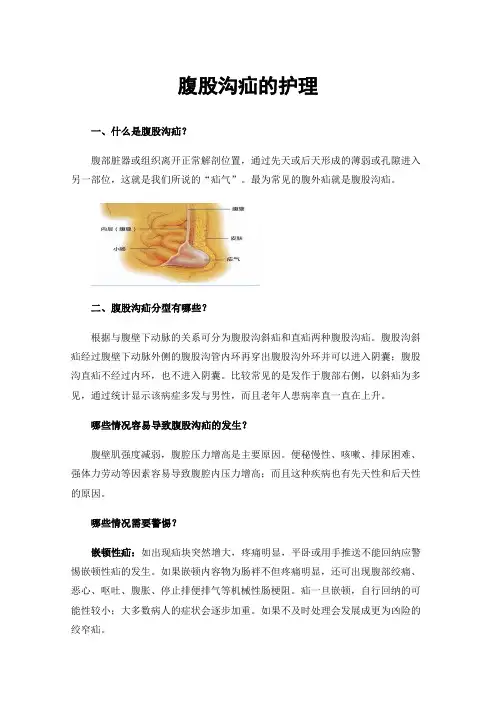 腹股沟疝的护理