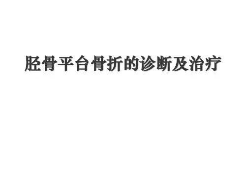 胫骨平台骨折PPT课件
