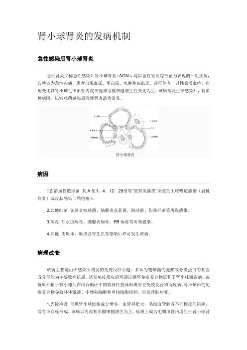 肾小球肾炎的发病机制