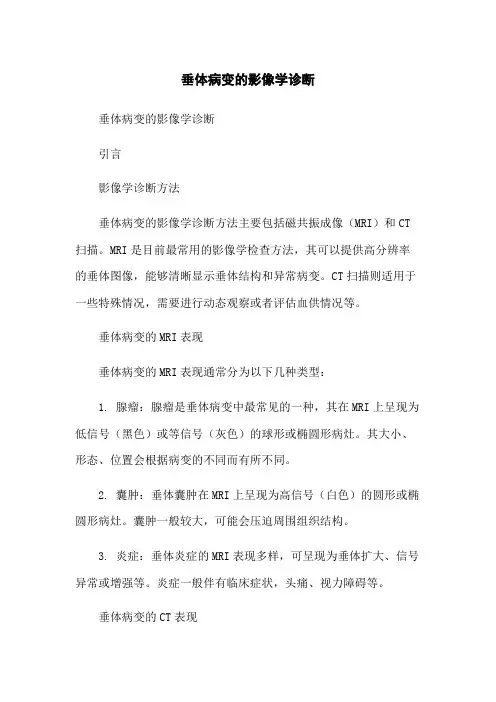 垂体病变的影像学诊断