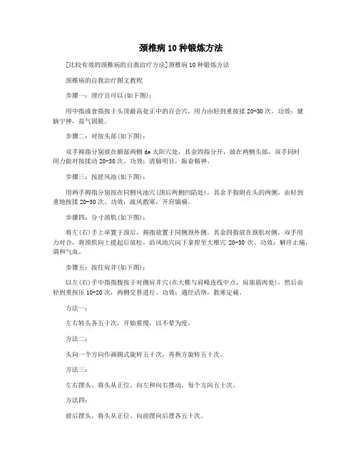 颈椎病10种锻炼方法