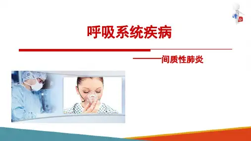 肺炎—间质性肺炎(病理学课件)