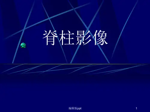 脊柱影像ppt课件