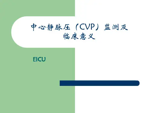 中心静脉压(CVP)监测EICU
