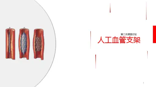 人工血管支架PPT课件