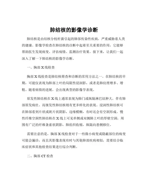 肺结核的影像学诊断