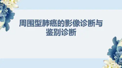 周围型肺癌的影像诊断与鉴别诊断