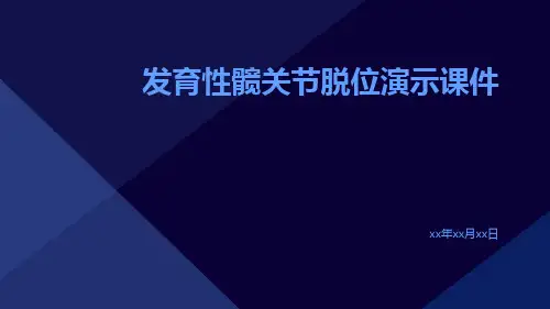 发育性髋关节脱位演示课件
