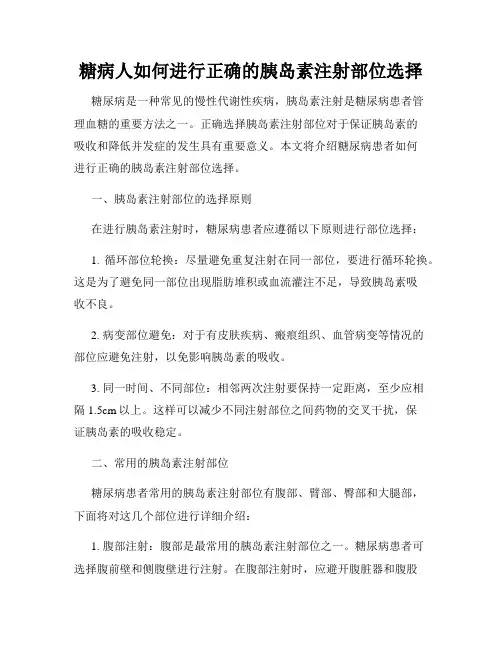 糖病人如何进行正确的胰岛素注射部位选择