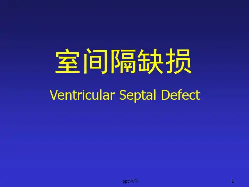 室间隔缺损  ppt课件