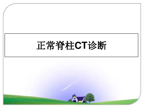 最新正常脊柱CT诊断课件ppt