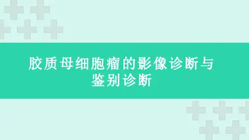 胶质母细胞瘤的影像诊断与鉴别诊断