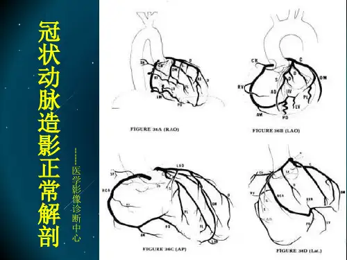 冠状动脉造影正常解剖课件ppt