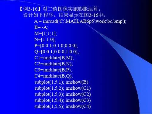 膨胀与腐蚀radonhough变换(1)