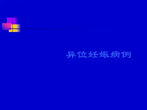 异位妊娠病例重点分析PPT