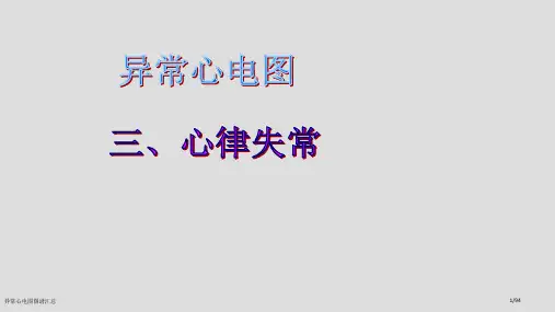 异常心电图图谱汇总