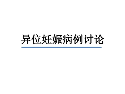 异位妊娠病例讨论