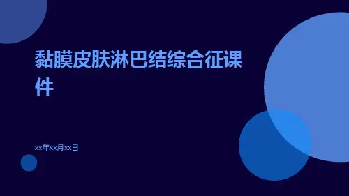 黏膜皮肤淋巴结综合征课件