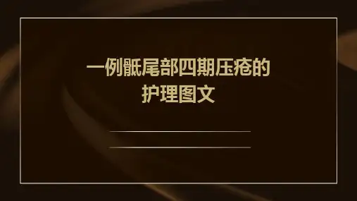 一例骶尾部四期压疮的护理图文