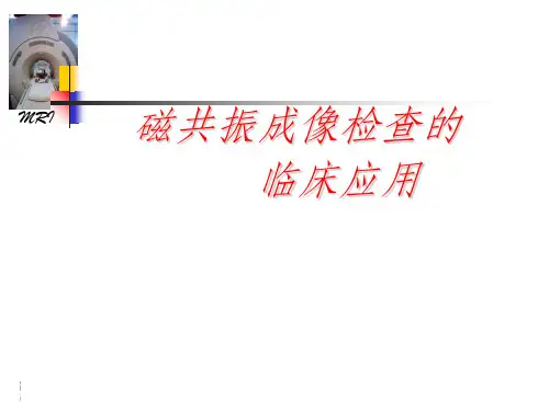 磁共振临床应用介绍