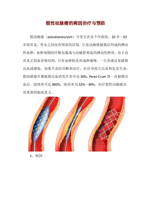 假性动脉瘤的病因治疗与预防