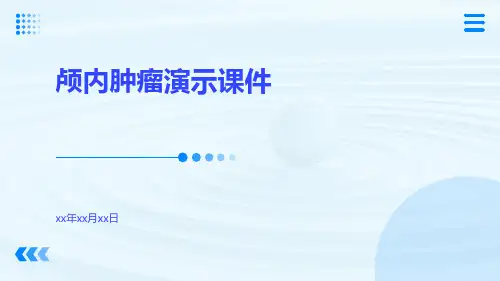 (医学课件)颅内肿瘤演示课件